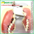 SELL 12610 Modelo de mandíbula para doença grave para treinamento em cirurgia periodontal